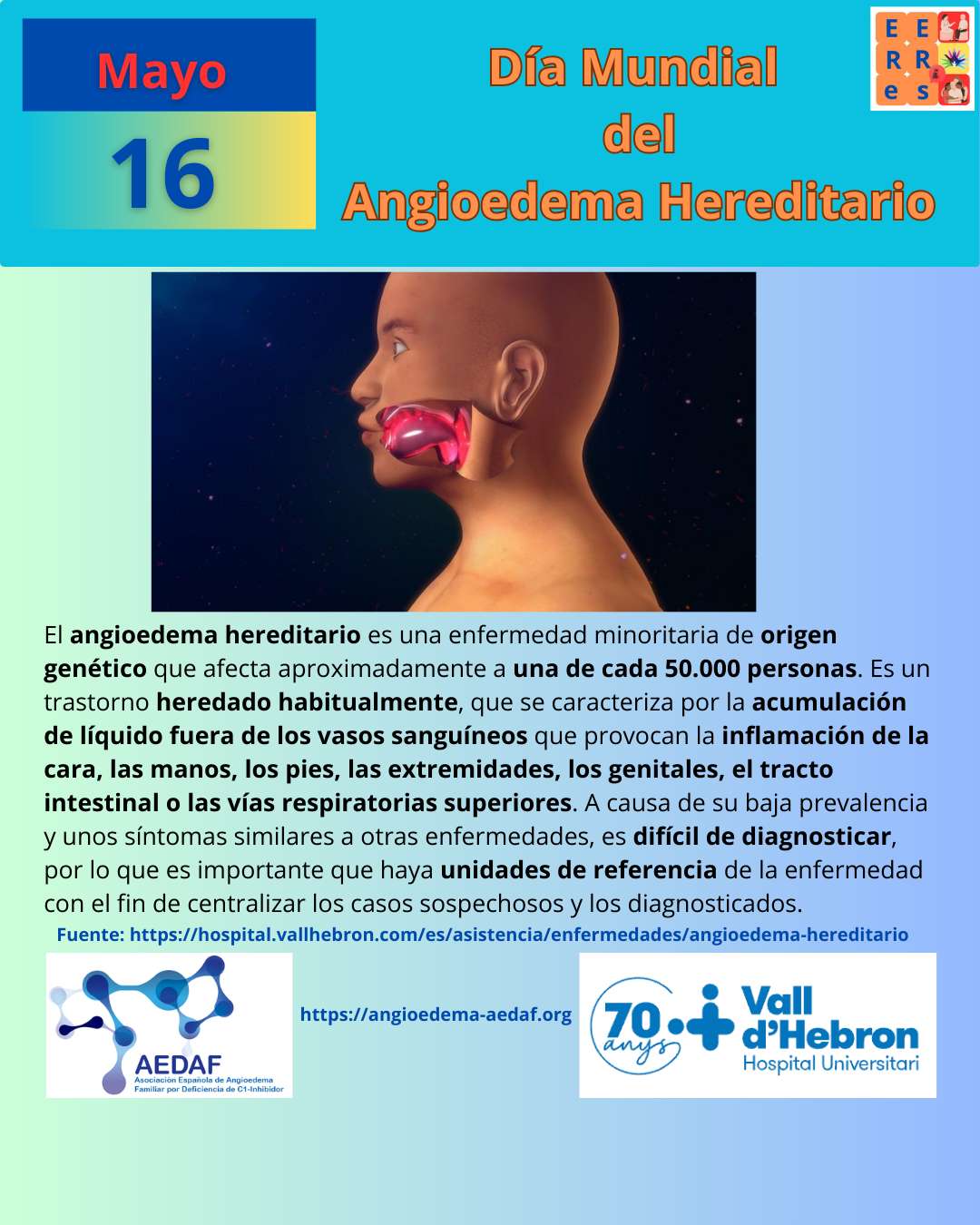 Mayo17 AngioedemaH