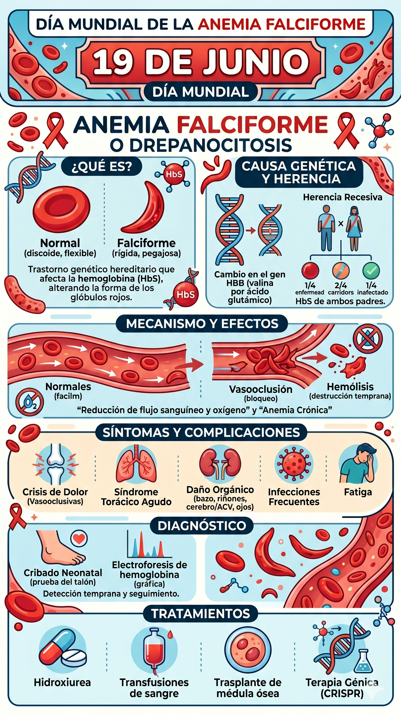 Imagen resumen sobre la anemia falciforme o dreapanocitosis en su día mundial 19 de junio- generada con Gemini IA