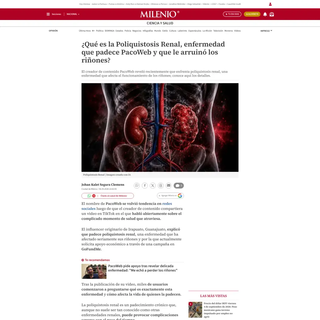 ¿Qué es la Poliquistosis Renal, enfermedad que padece PacoWeb y que le arruinó los riñones?
