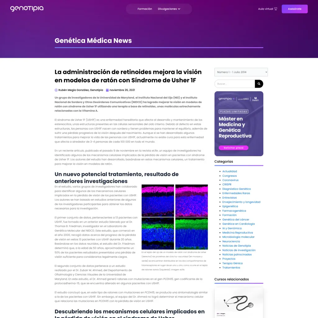 La administración de retinoides mejora la visión en modelos de ratón con Síndrome de Usher 1F