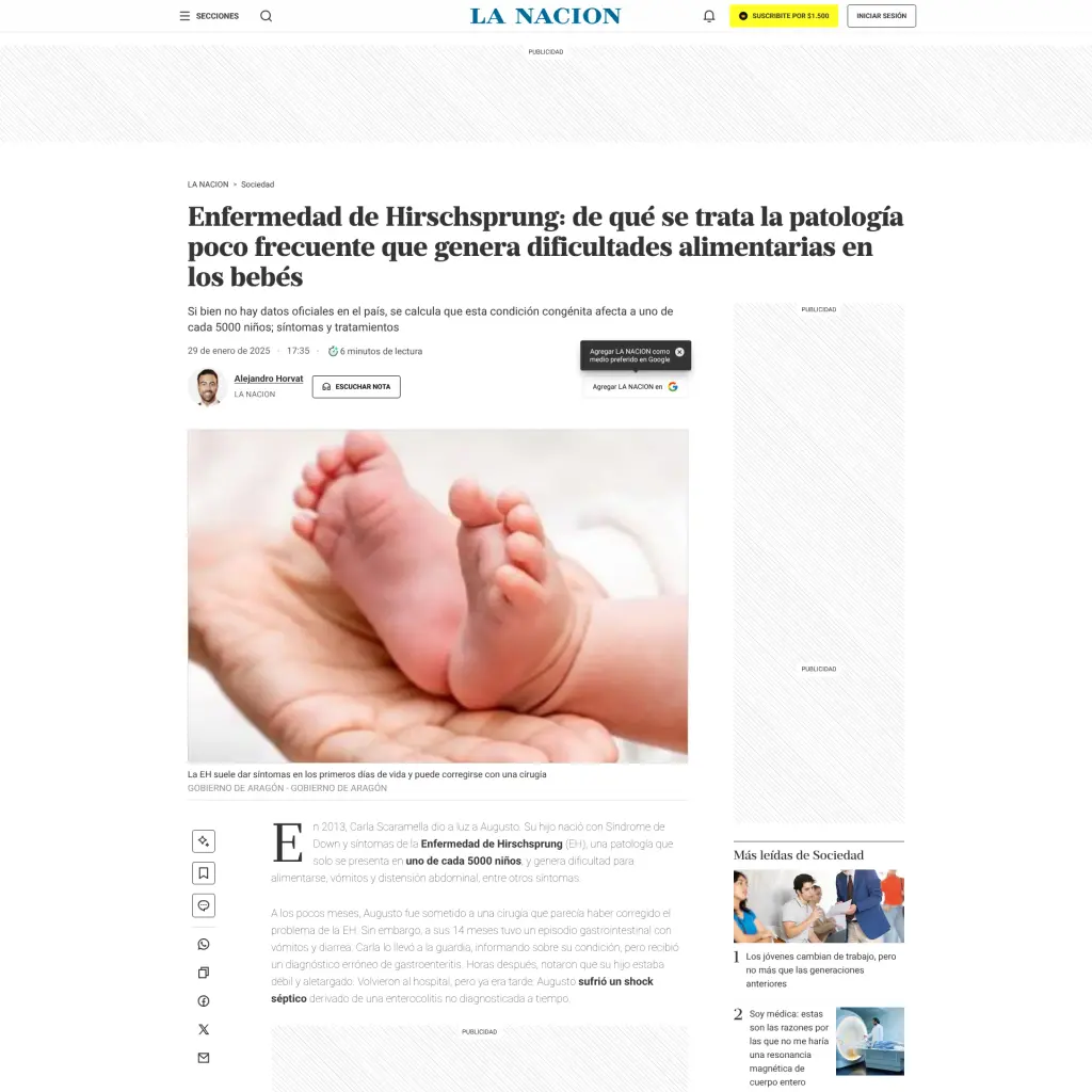 Enfermedad de Hirschsprung: de qué se trata la patología poco frecuente que genera dificultades alimentarias en los bebés