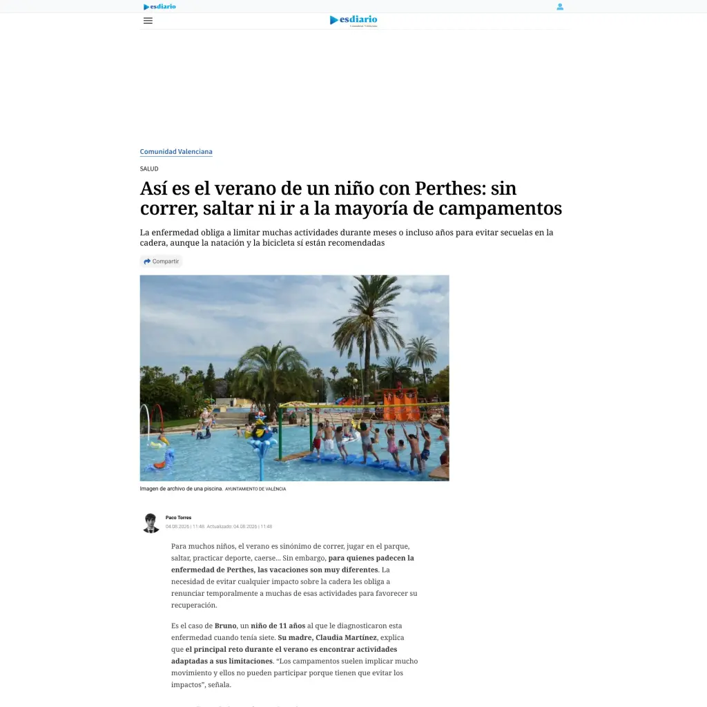 Así es el verano de un niño con Perthes: sin correr, saltar ni ir a la mayoría de campamentos