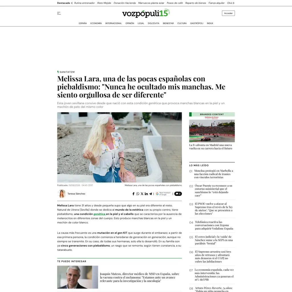 Melissa Lara, una de las pocas españolas con piebaldismo: "Nunca he ocultado mis manchas. Me siento orgullosa de ser diferente"
