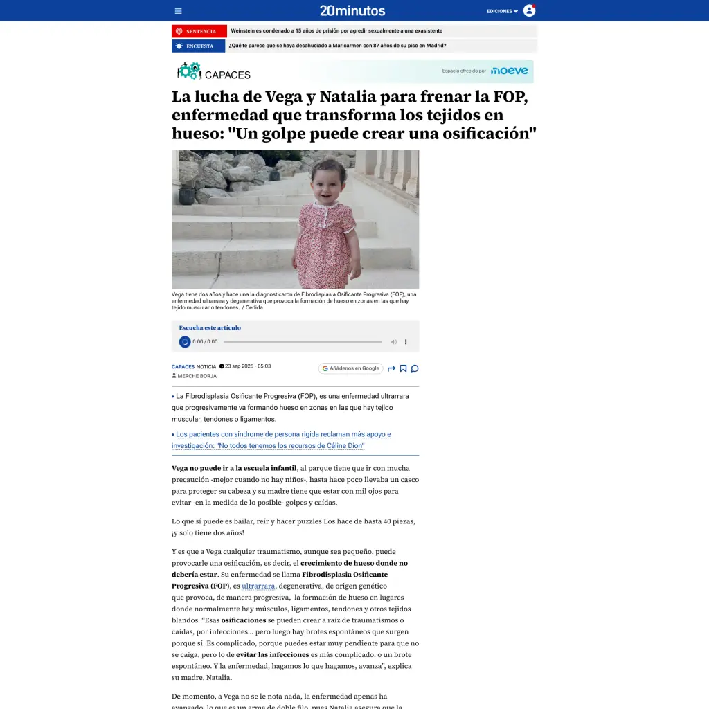 La lucha de Vega y Natalia para frenar la FOP, enfermedad que transforma los tejidos en hueso: "Cualquier golpe crea una osificación"