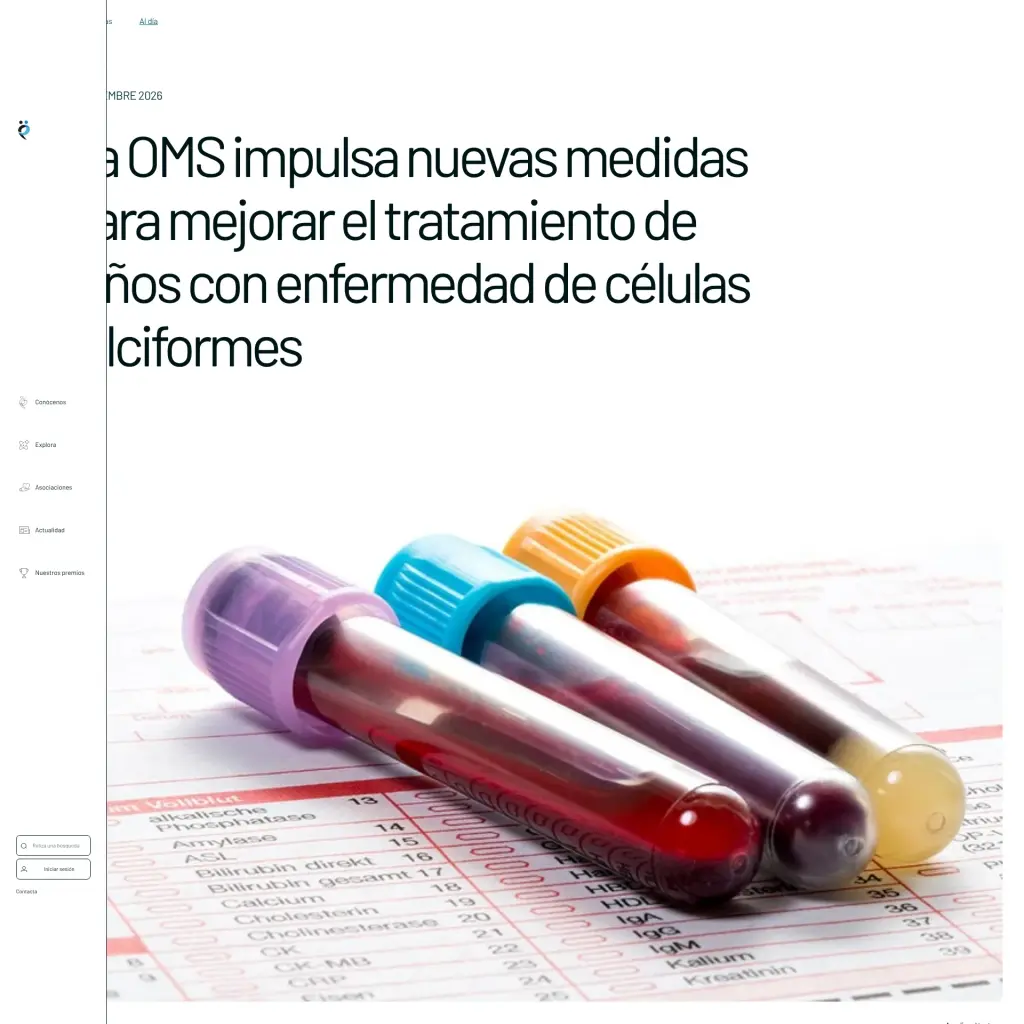 La OMS impulsa nuevas medidas para mejorar el tratamiento de niños con enfermedad de células falciformes